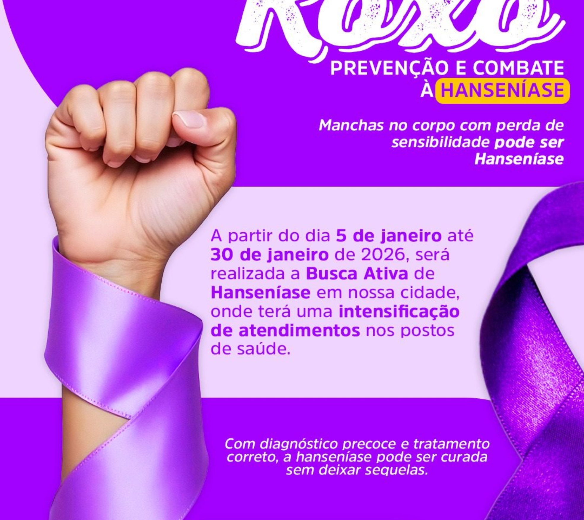 Janeiro Roxo chegou! Descubra como identificar sinais da hanseníase e garantir tratamento precoce – sua saúde não pode esperar. Foto:. Prefeitura De Mairinque